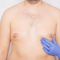 Fat Grafting in Hyderabad