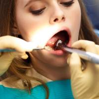 Maxillofacial Surgery in Hyderabad