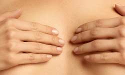 Breast Reduction Surgery