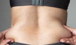 Liposuction 