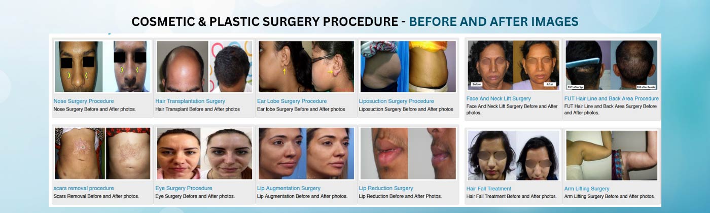 Cosmetic and Plastic Surgery Before and After Images