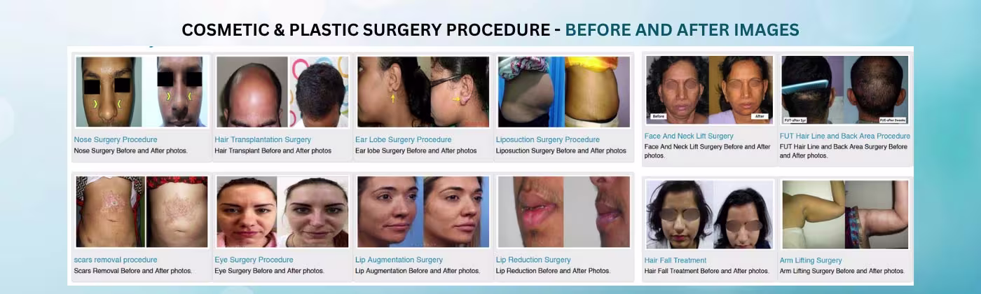 Cosmetic and Plastic Surgery Before and After Images