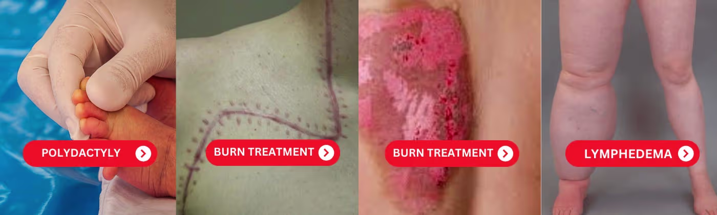 Cosmetic Surgeon In Hyderabad