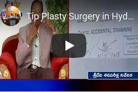 Tip Plasty Surgery in Hyderabad