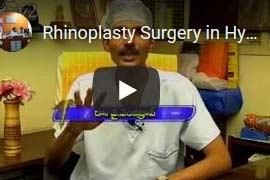Rhinoplasty Surgery in Hyderabad - Part1