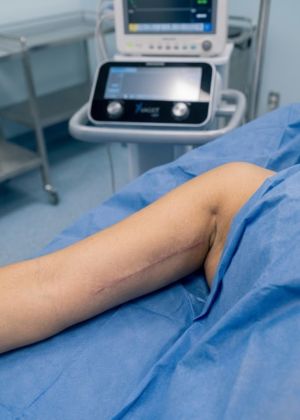 arm area