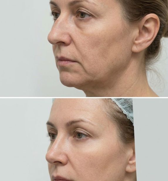 cosmetic procedure