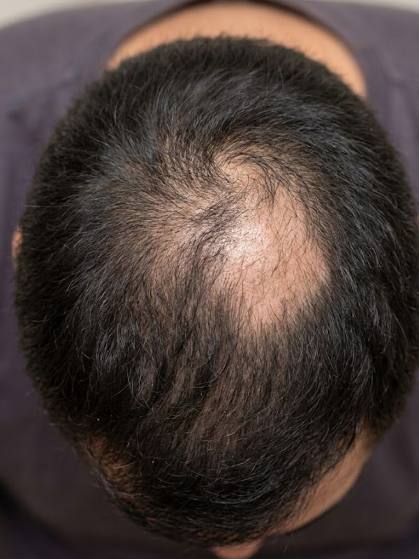 skin and hair fall treatment