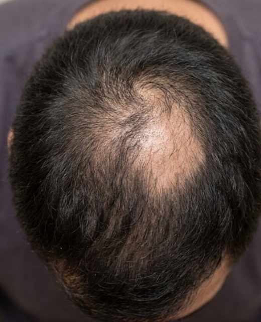 skin and hair fall treatment
