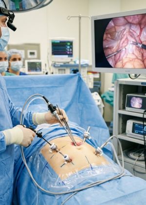 laproscopic treatment