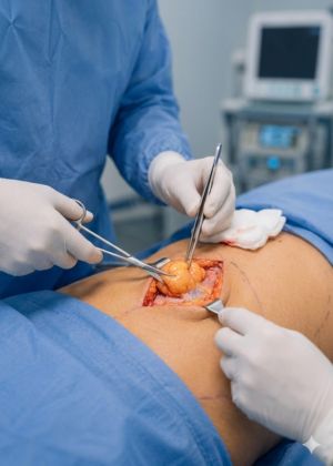 lipoma treatment