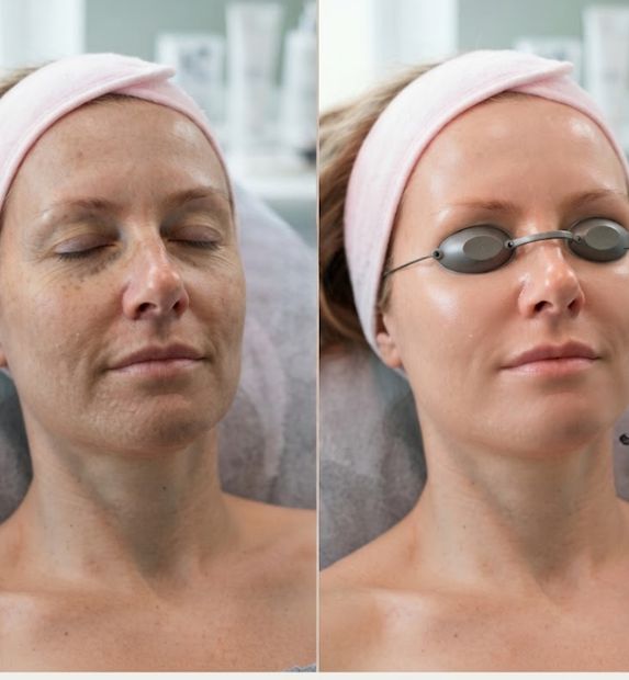 red light therapy results
