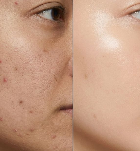 Skin Maintance