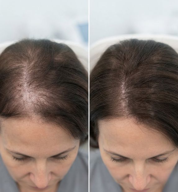 stem cells therapy results