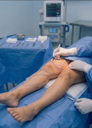 thigh treatment