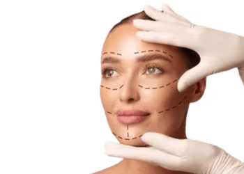 Face Lift Surgery in Hyderabad