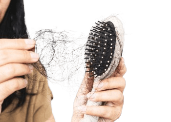 How To Control Hair Fall Treatment in Hyderabad