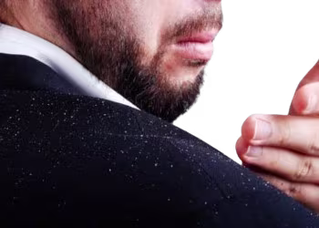 Dandruff Treatment in Hyderabad