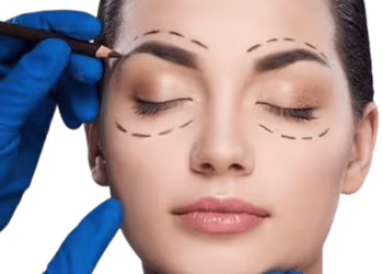 Eyelid Surgery in Hyderabad