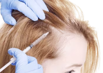 Follicular Unit Extraction Treatment in Hyderabad