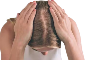 Hair Loss Treatment in Hyderabad