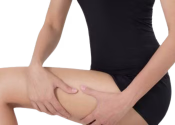 Thigh Shaping Treatment in Hyderabad