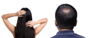 Hair Transplant cost