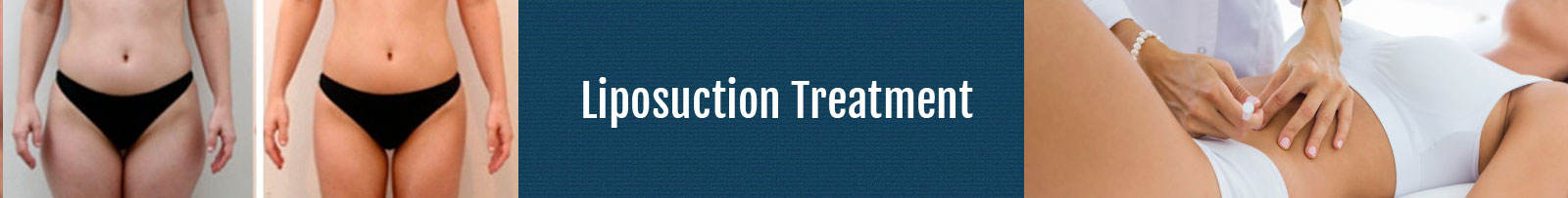 Post-Bariatric Surgery in Hyderabad Post-Bariatric Surgery in Hyderabad