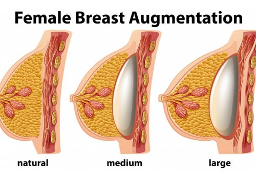 Breast augmentation Precautions