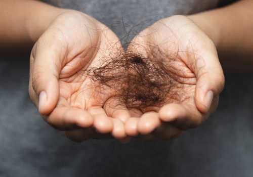 Hair Loss Treatment