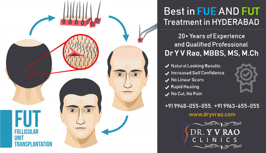 Are Looking For PRP Hair Loss Treatment In Hyderabad  Hyderabad  Zamroo