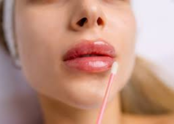 Lip Augmentation in Hyderabad